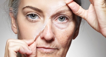 Peeling de fenol: saiba o que é e quais cuidados devem ser tomados